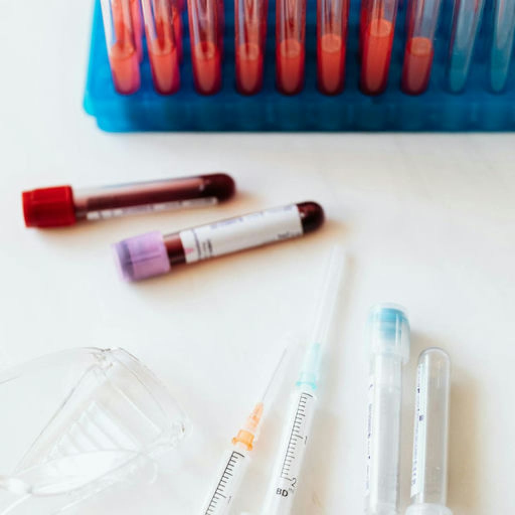 Un análisis de sangre predice el riesgo de enfermedad cardiovascular en las mujeres 30 años antes