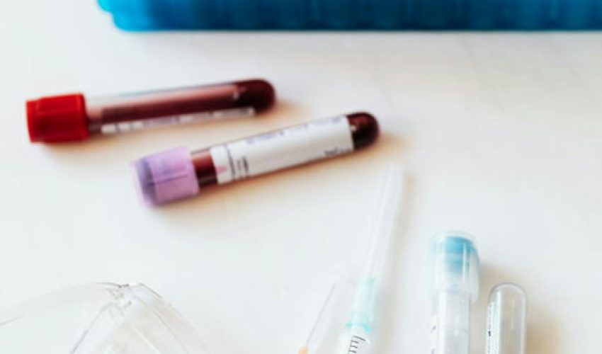 Un análisis de sangre predice el riesgo de enfermedad cardiovascular en las mujeres 30 años antes